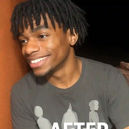 After 4 weeks — cheek looks more even; dark spots reduced