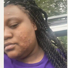 Before — forearm with uneven tone