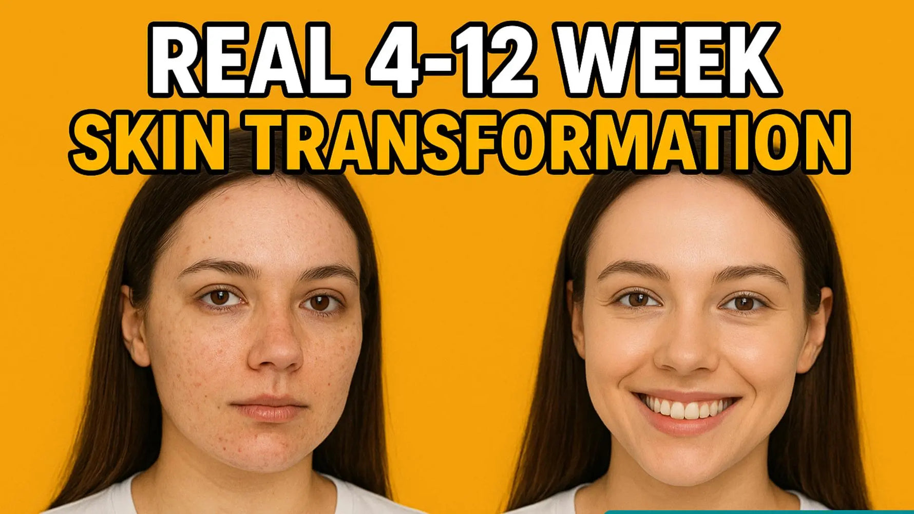 Turmeric Kojic Acid Soap Before and After: Realistic Results Timeline