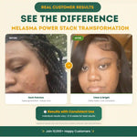 Before and after comparison of a person's skin with text about product results.