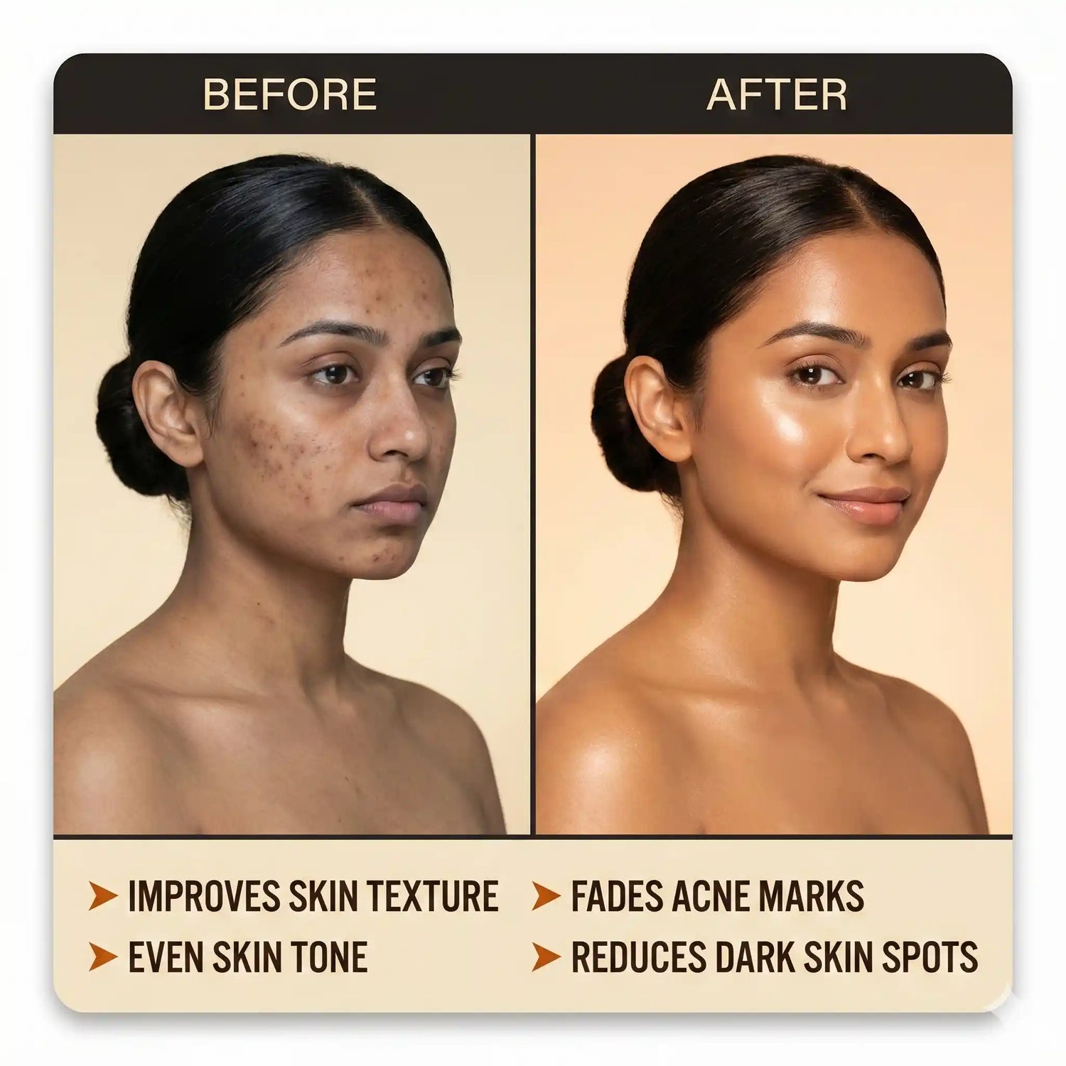 Before and after comparison of skin improvement with text on a beige background
