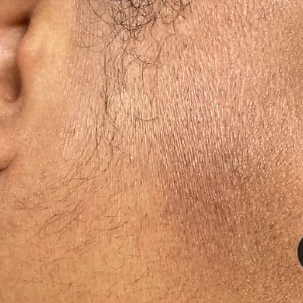 After 2 weeks — face looks brighter and healthier