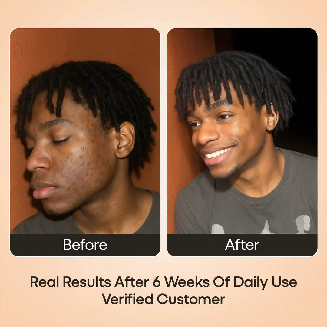 Turmeric serum for melanin-rich skin. No bleach. Real results. Free shipping $19+