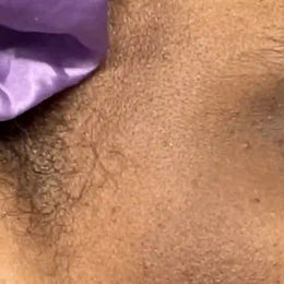 Before — face with dull skin