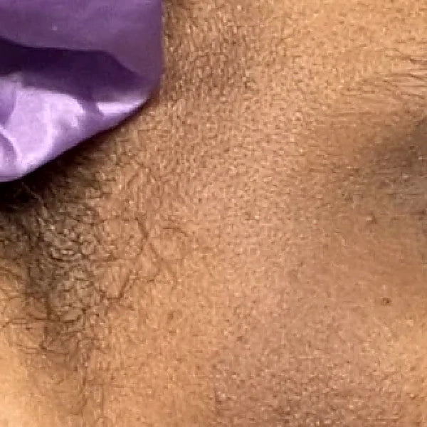 Before — face with dull skin