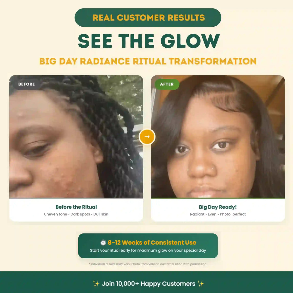 Before and after comparison of a person's skin with text about a radiance ritual transformation.