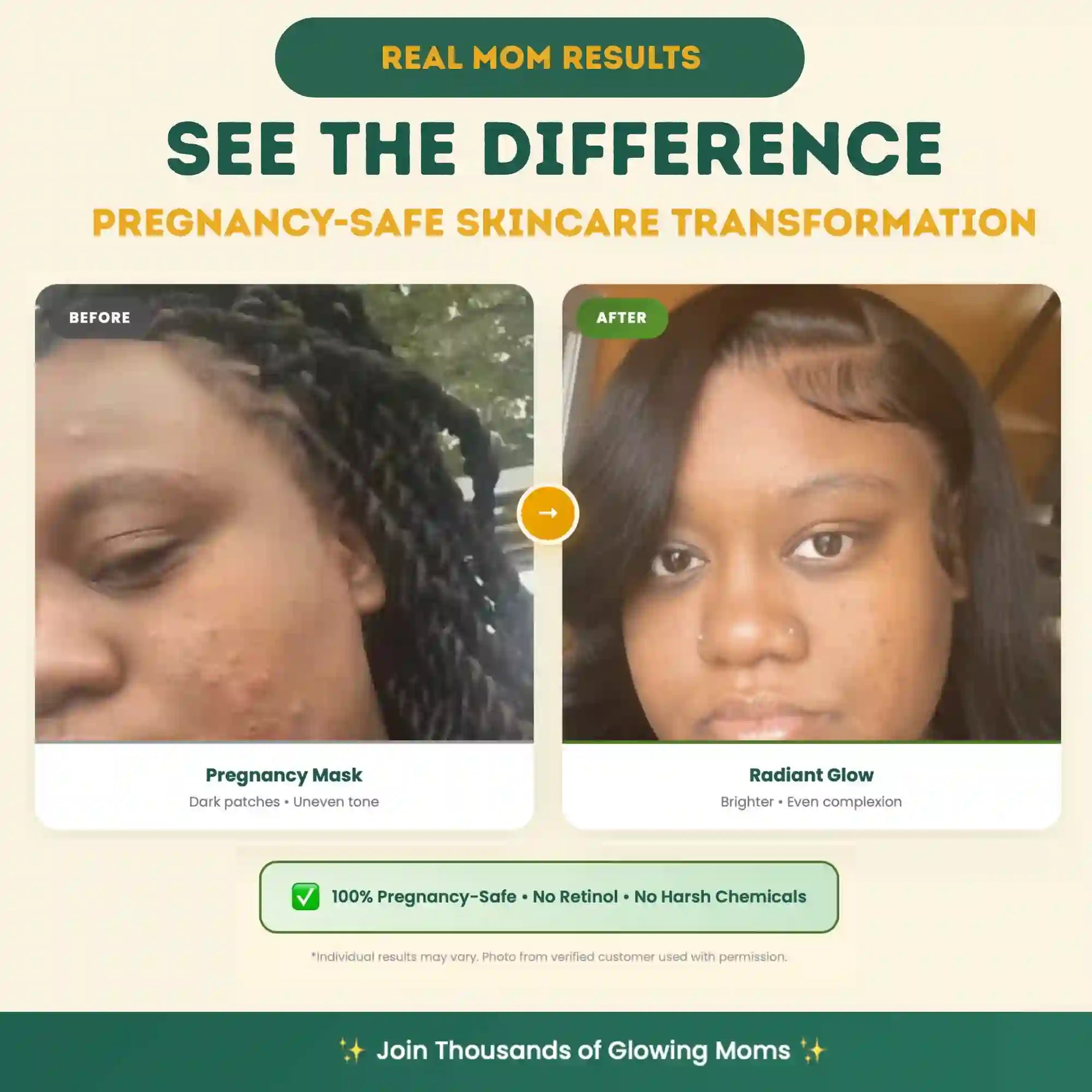 Before and after comparison of pregnancy-safe skincare transformation with text overlay.