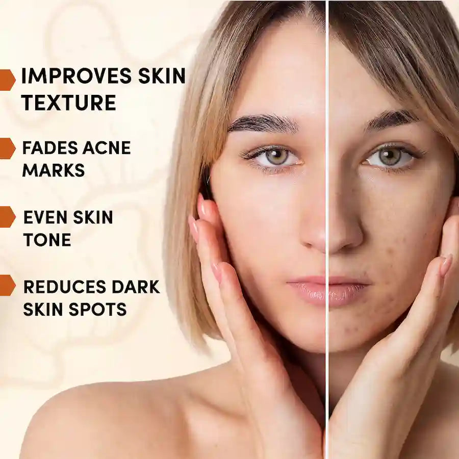 Before and after comparison of a woman's face with text highlighting skin improvement benefits.