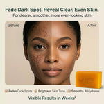 Before and after comparison of a woman's face with a bar of AMVita Naturals soap.
