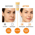 Before and after comparison of a woman's face with a tube of cream labeled 'Turmeric Soothing'.