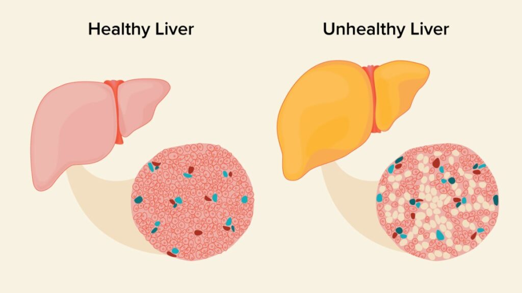 turmeric for liver health