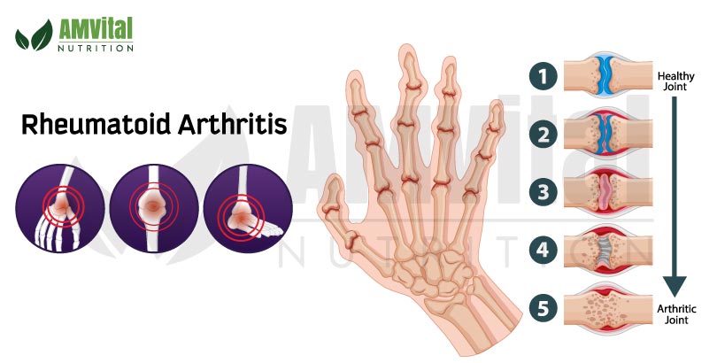 turmeric for rheumatoid arthritis