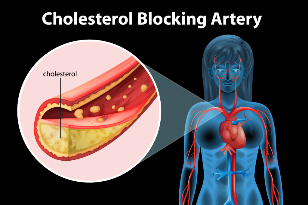 turmeric for arteries