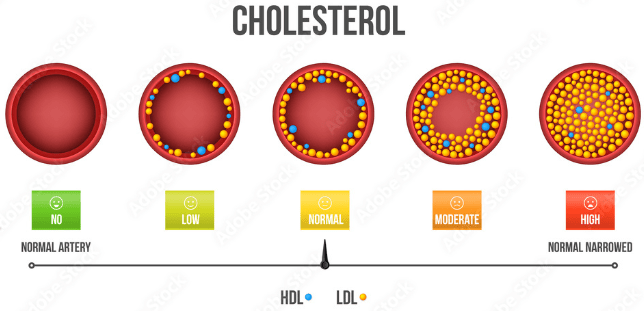 turmeric lower cholesterol