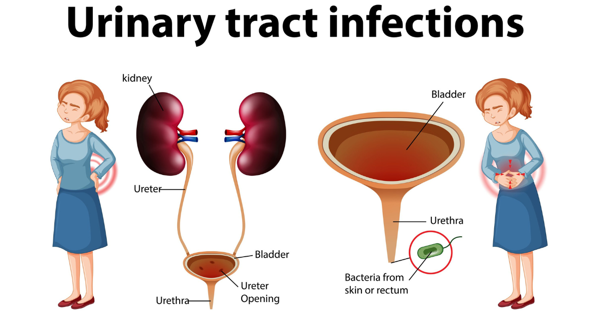 urinary tract infections