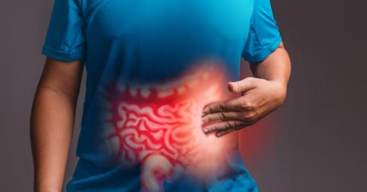 Turmeric for IBS: All You Need to Know