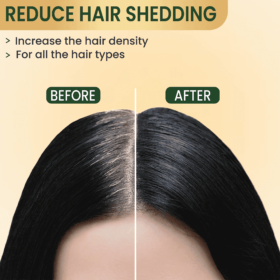 Amvital hair growth serum product