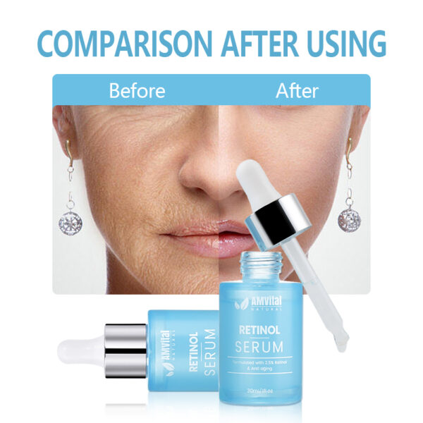 Retinol Serum 5