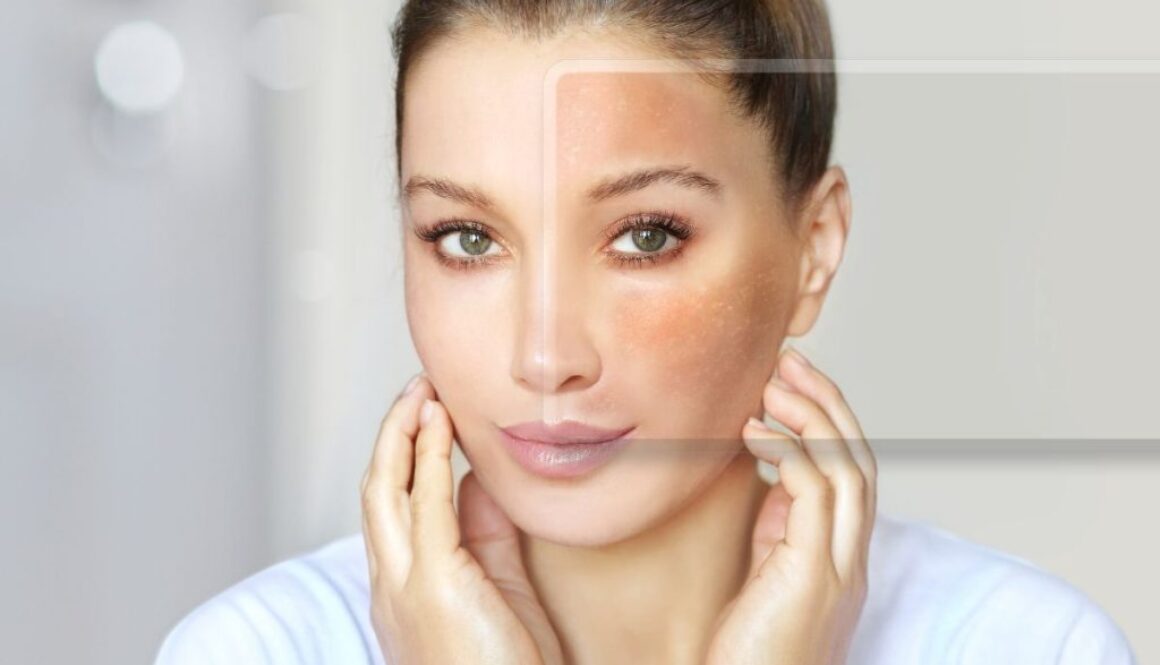 The woman gets rid of dark spots due to the use of Kojic acid.