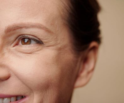 The woman has wrinkles on her face.