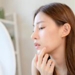 The woman has acne on her face.